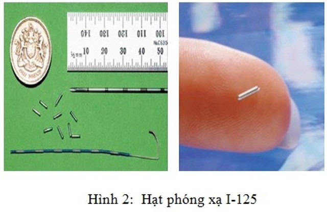 Can canh cay phong xa chua ung thu tuyen tien liet o VN-Hinh-10